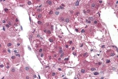 Immunohistochemistry-Paraffin: TM9SF1 Antibody [NBP3-14498]